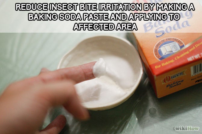 bug bite baking soda hack